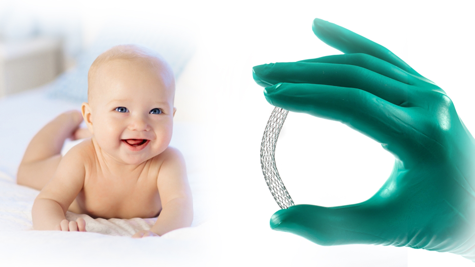 FDA-approved Minima Growth Stent for pediatric heart care