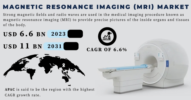 Magnetic Resonance Imaging (MRI) Market Revenue Analysis